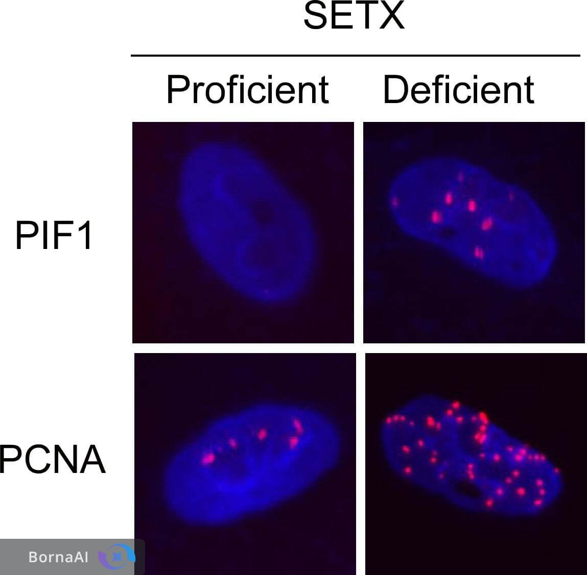 کشف نقطهضعف پنهان سرطان در مقابله با آسیب DNA کشف نقطهضعف پنهان سرطان در مقابله با آسیب DNA