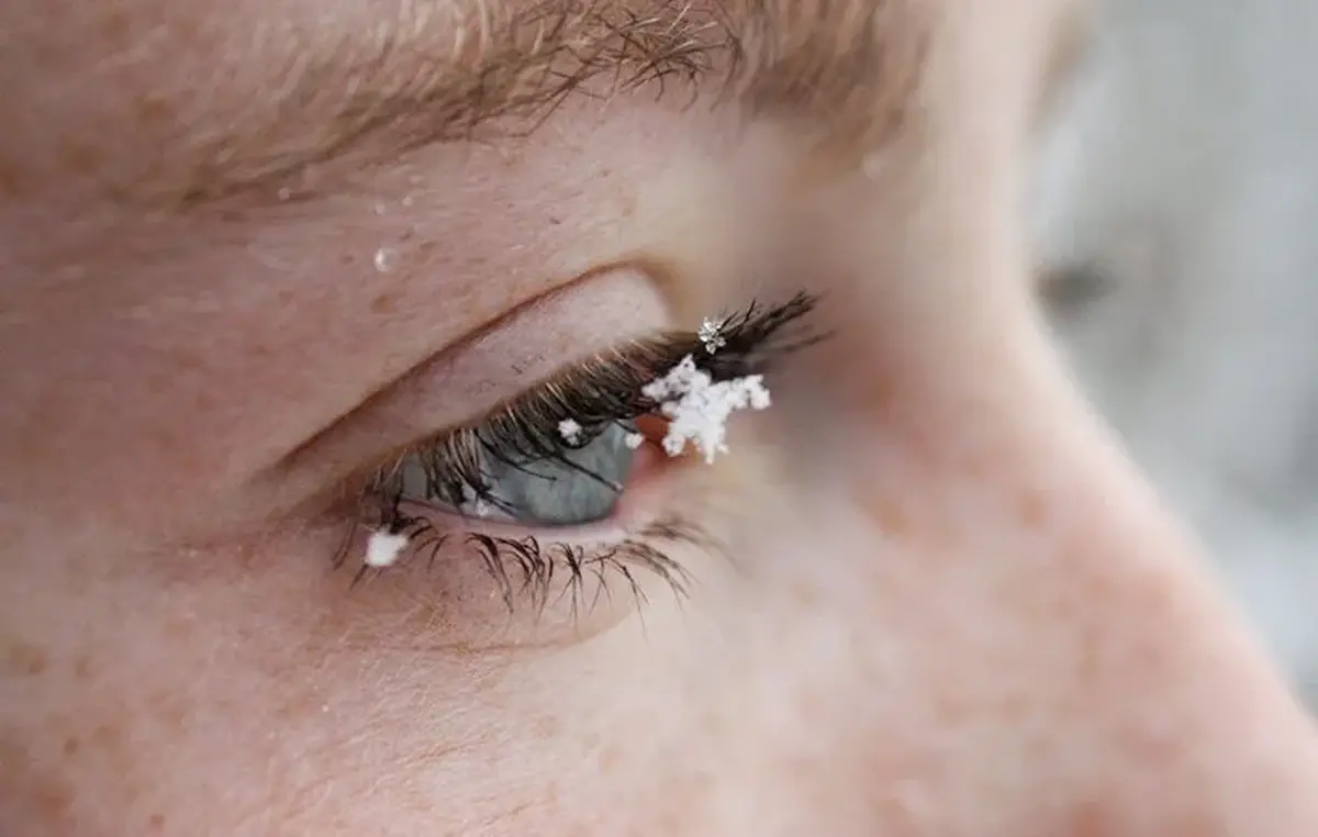 روش های کنترل خشکی چشم در زمستان